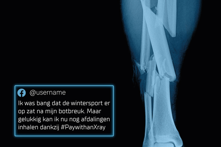 pay with an xray